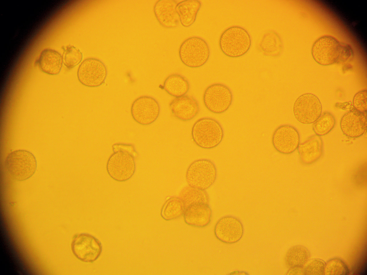 Рис. 8. Эцидиальная стадия ржавчины лука: В - эцидиоспоры