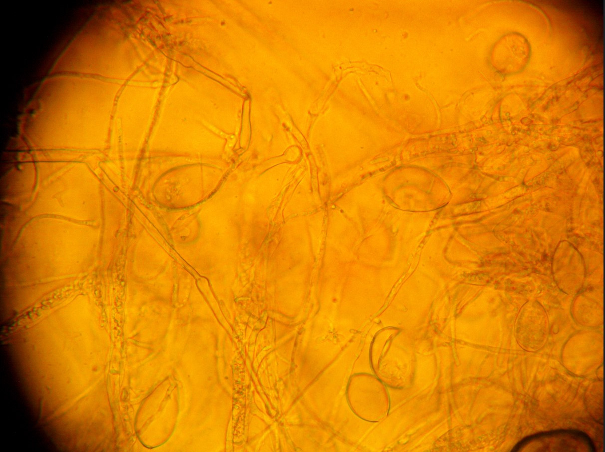 Рис.5А. Зооспорангии гриба Ph.infestans